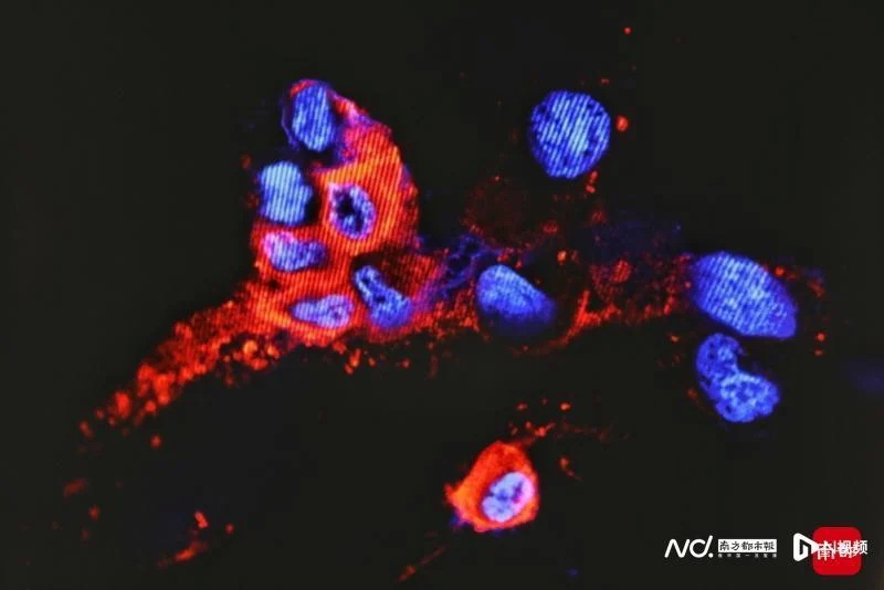 免疫荧光图像检测变种变异毒株的NP蛋白24小时感染组，